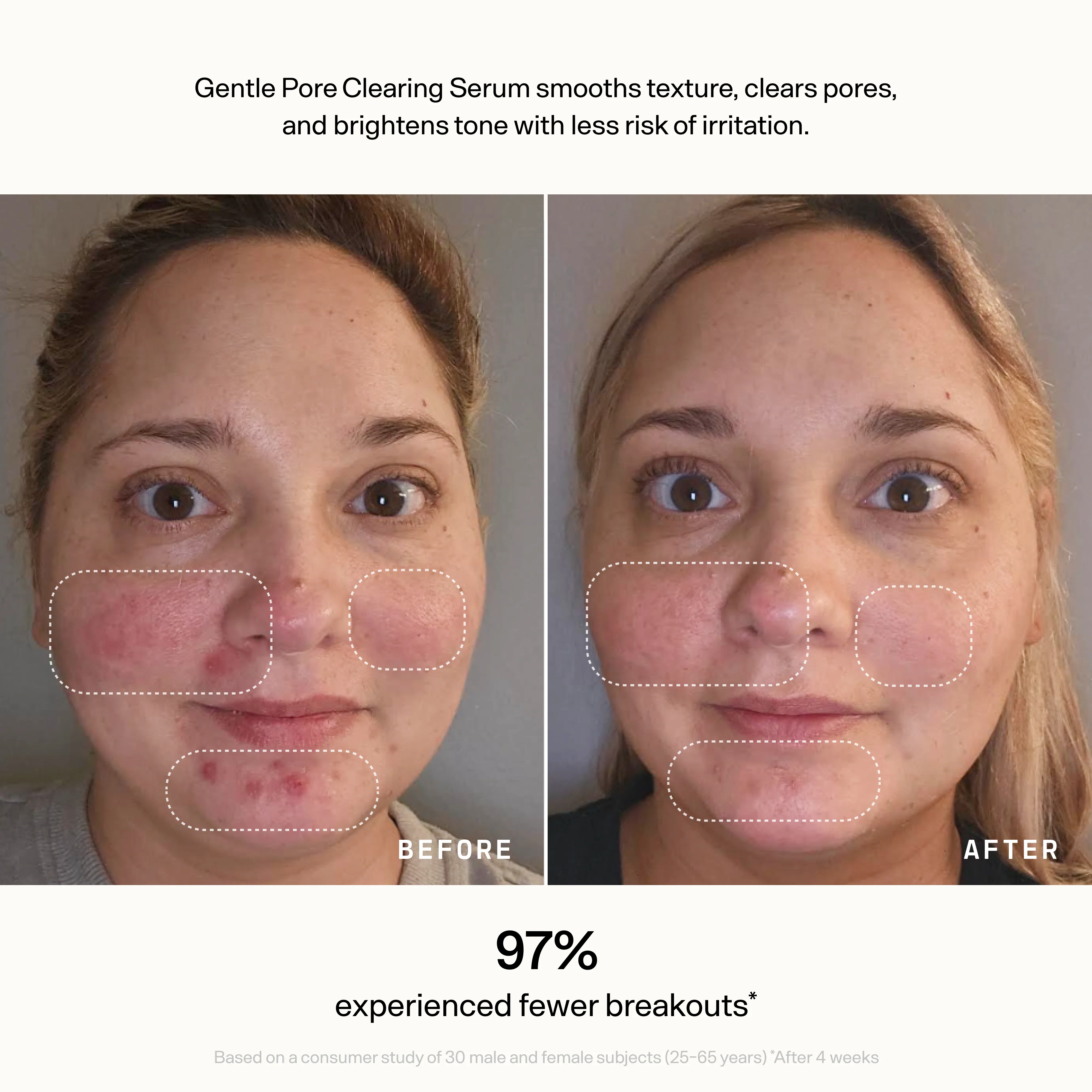 Skin Refine - Image 5